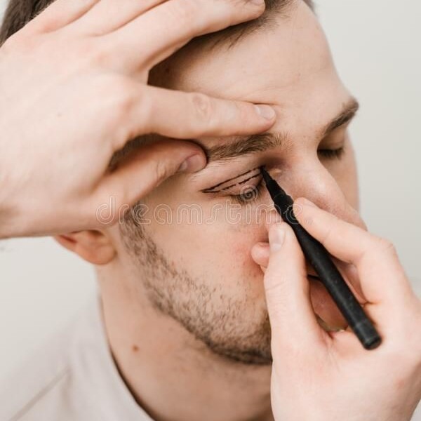 Eyelid Surgery in Riyadh