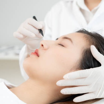 Rhinoplasty in Riyadh