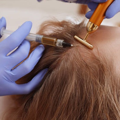 PRP Hair Treatment in Riyadh