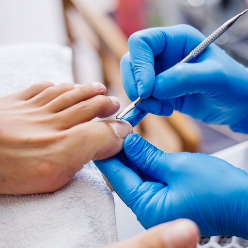 Ingrown toenail surgery in Riyadh